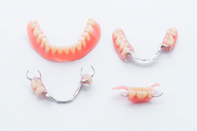 The image shows a collection of dental implants and braces, including full sets for upper and lower teeth, displayed against a white background.